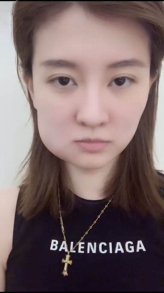 乔欣脸肿成特效 活像在进食的松鼠